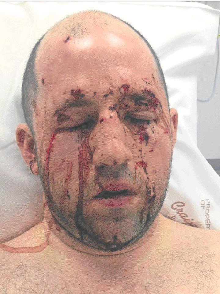 Victim of south Armagh booby trap Francis McCabe